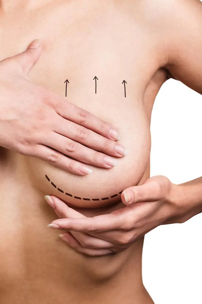 Breast Reduction, Cosmetic Surgery